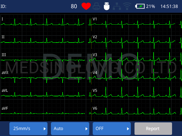 Máquina de ECG Digital de Tres Canales Zoncare de Alta Gama / Máquina de Electrocardiograma con Carro Opcional Mslec41