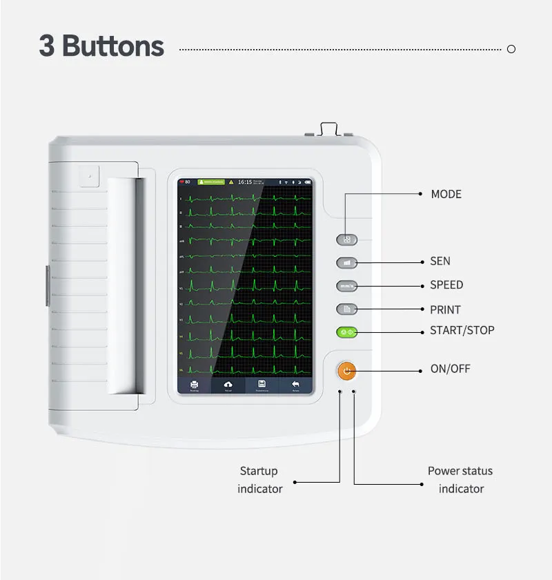 ECG4