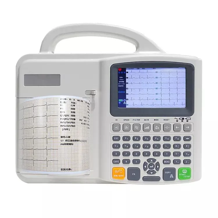 Analizador de ECG
