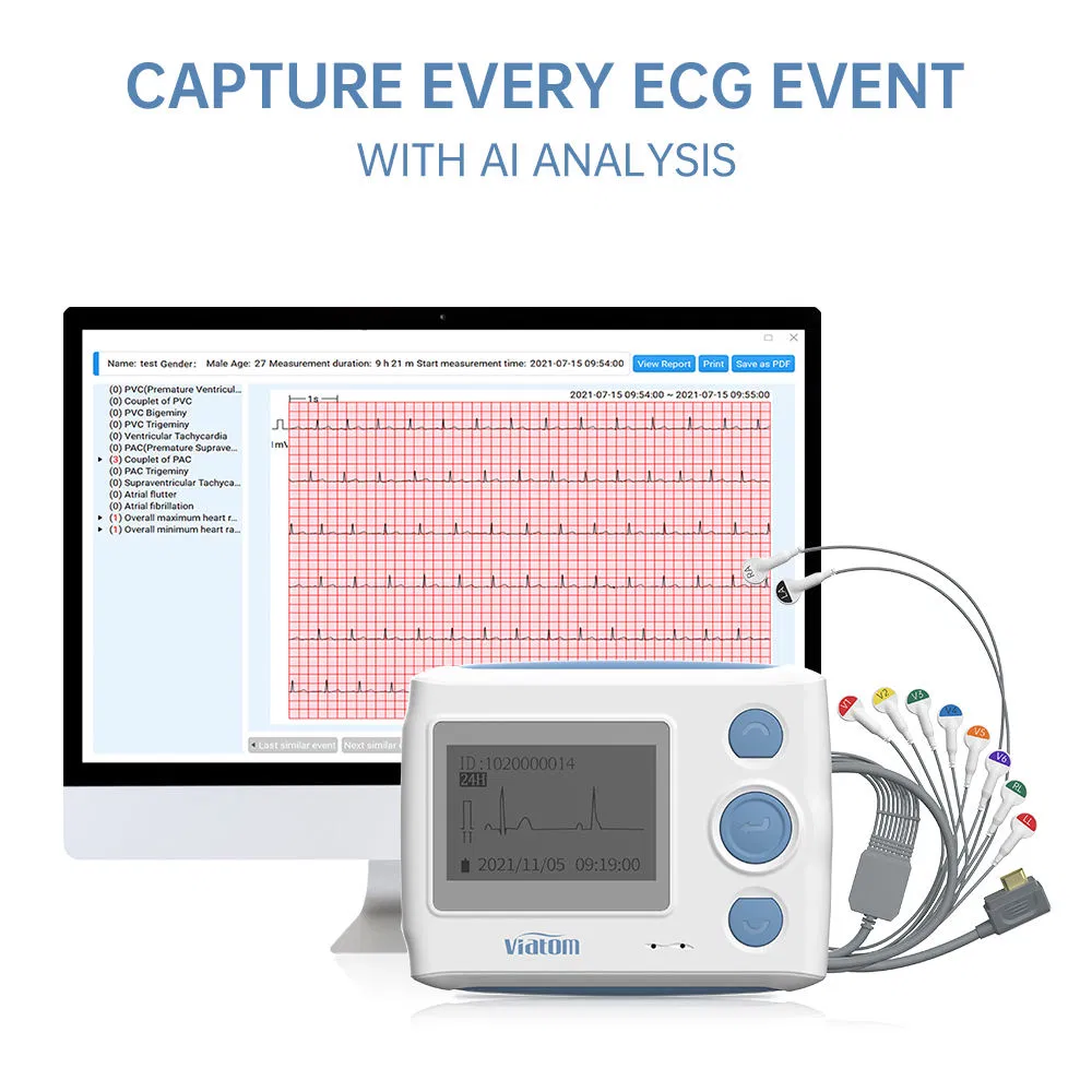 Monitor Holter ECG portátil 24-Hour 12-Lead