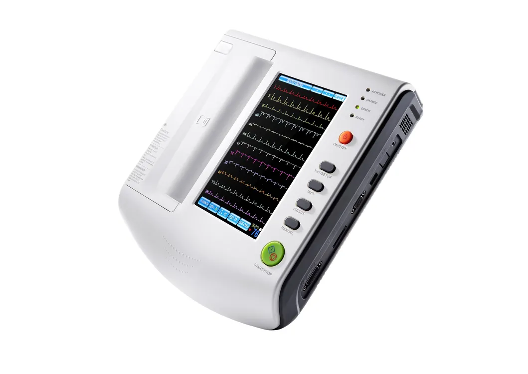 Detalle ECG 1