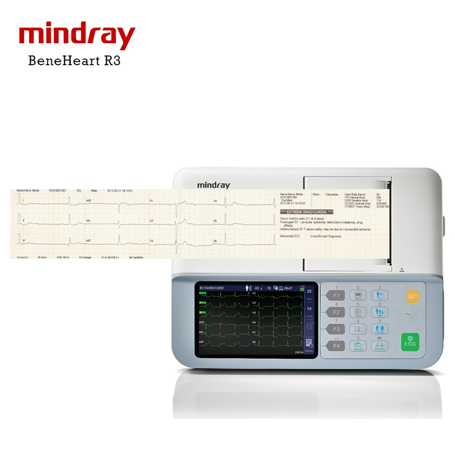 Mindray BeneHeart R3 Venta Caliente Digital 6 Canal Portátil Máquina de ECG Electrocardiógrafo