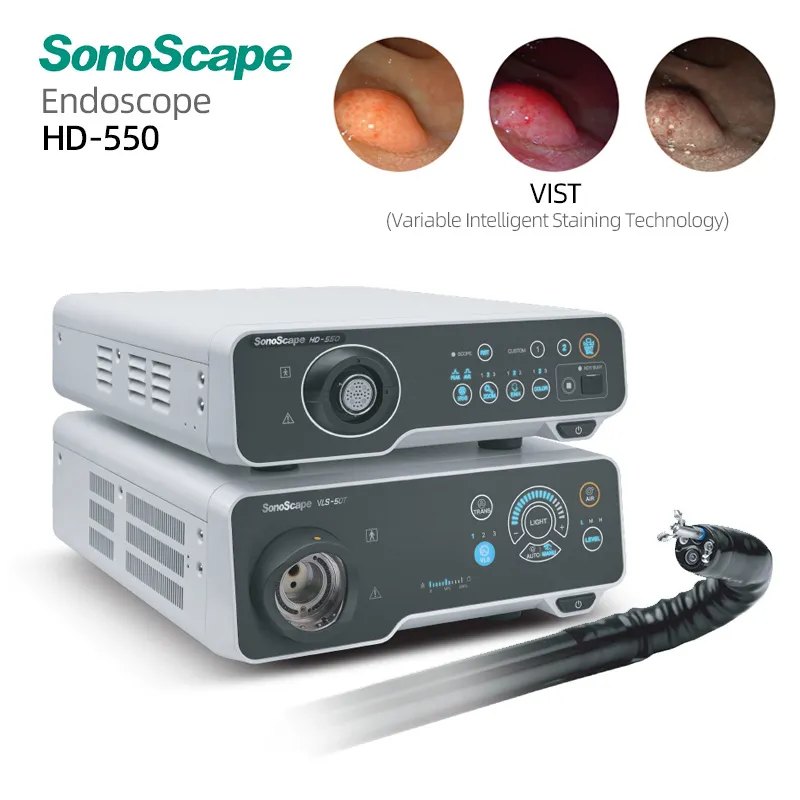 Sonoscape HD-550 3