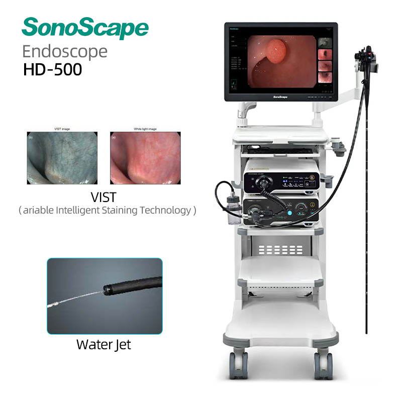 Sistema de Endoscopia Hospitalaria Sonoscape Certificado CE HD-500 Versátil Inteligente de Tinción Potenciado para Exámenes Gi Mínimamente Invasivos