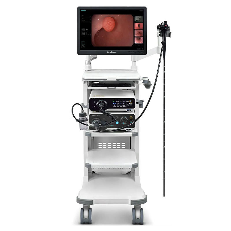 Sistema de Endoscopia Hospitalaria Sonoscape Certificado CE HD-500 Versátil Inteligente de Tinción Potenciado para Exámenes Gi Mínimamente Invasivos