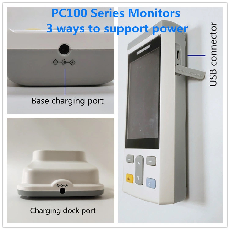 Monitor de Pacientes Portátil Veterinario Recargable con ECG NIBP SpO2