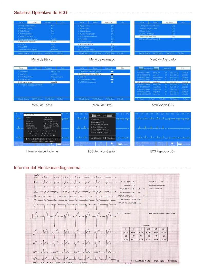 ECG Máquina 4