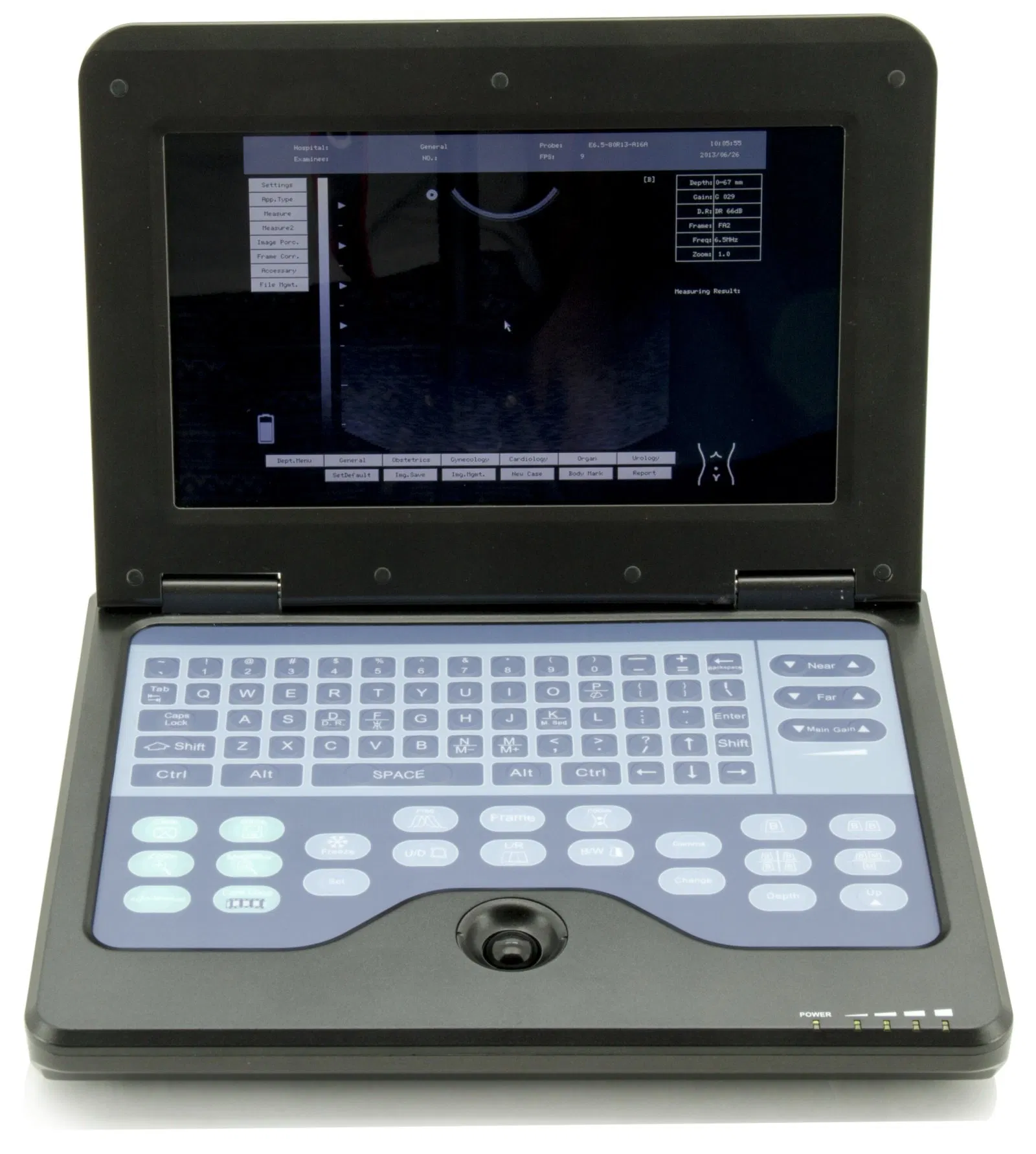 Contec Cms600p2 Cuaderno de Equipos Médicos del Hospital Sistema de Ultrasonido Diagnóstico