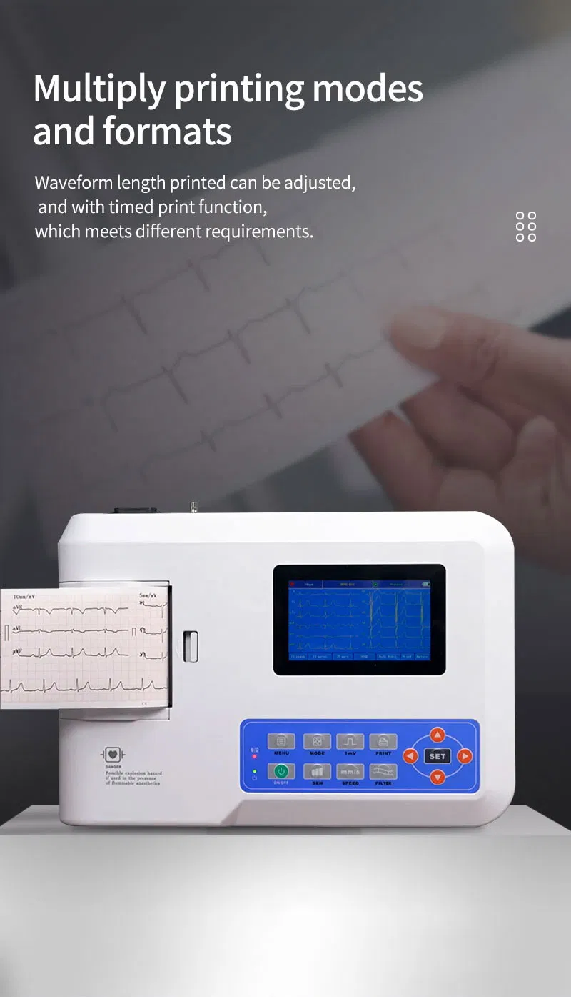 ECG 5