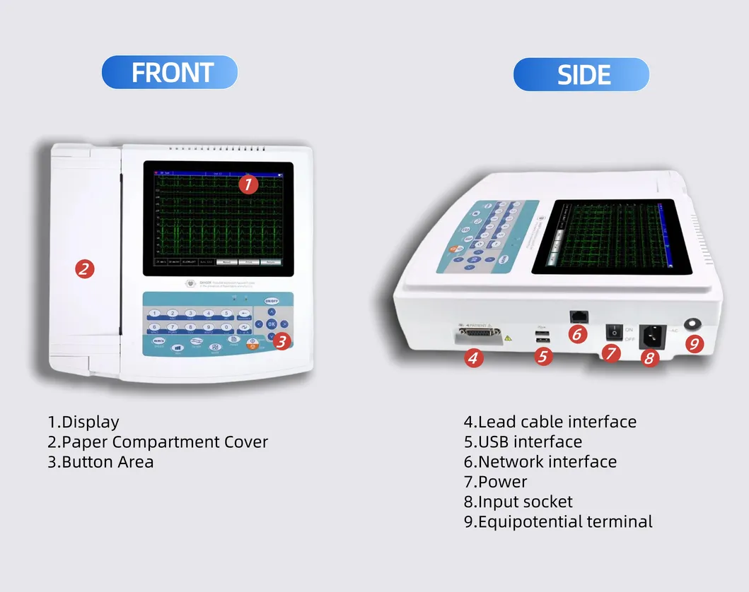 Pantalla de Diagnóstico ECG