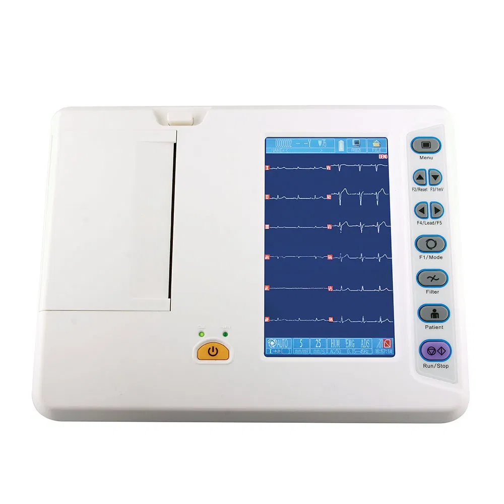 Detalle ECG