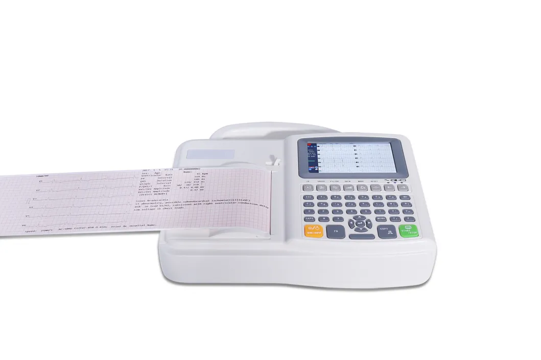 ECG Machine View 5
