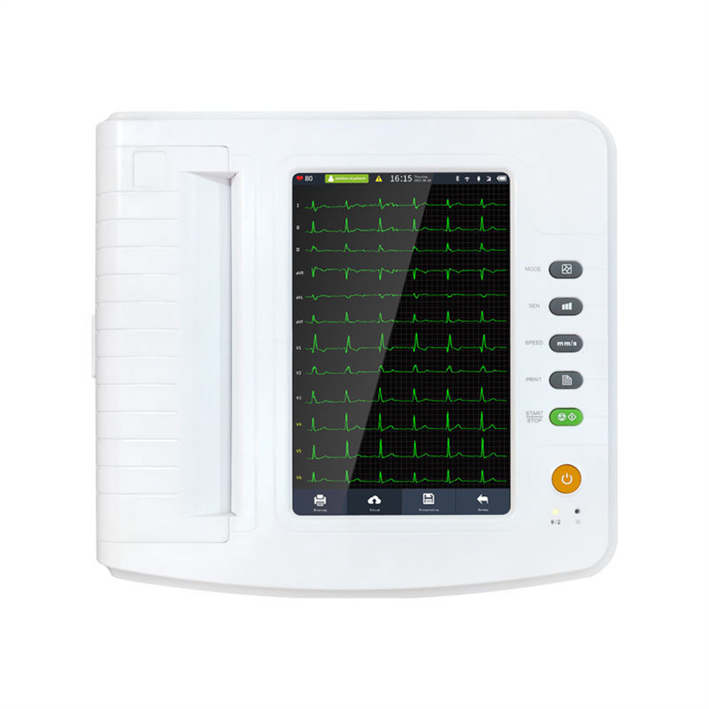 Monitor de ECG Avanzado 12-Channel con Pantalla a Color para Profesionales