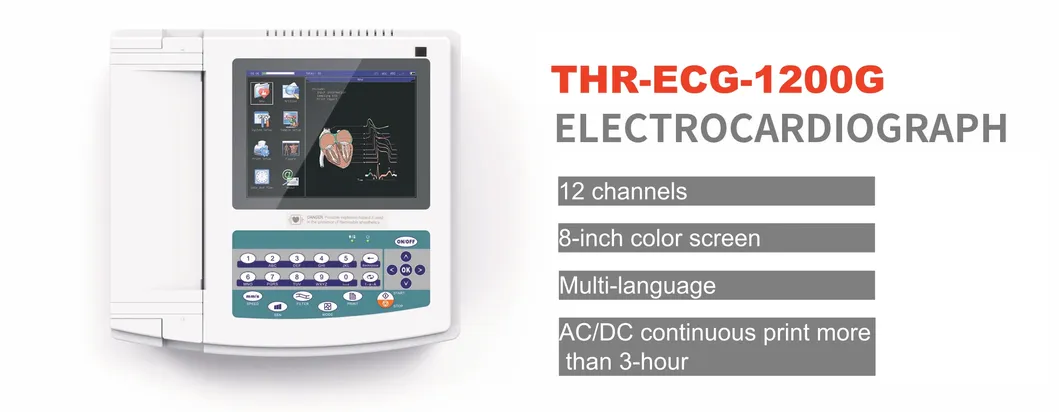 Gráficos de Tendencias ECG