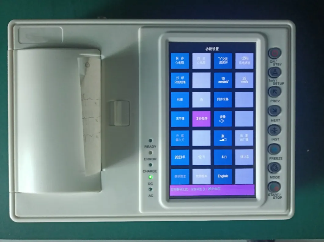 Diagnóstico ECG 2