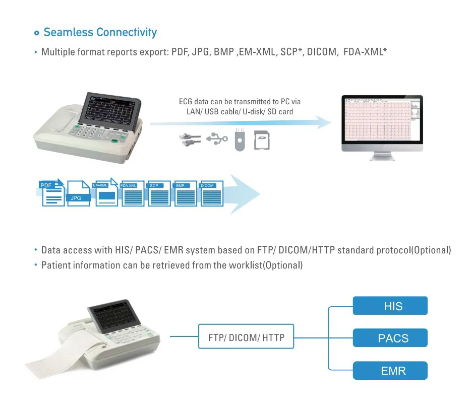 Máquina de Electrocardiografía ECG 1