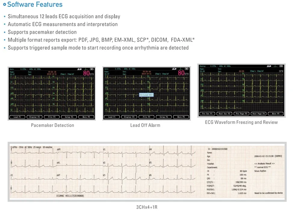 Máquina de ECG portátil vista 2