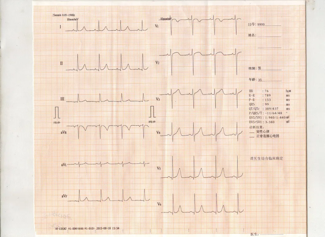 Detalle ECG 6