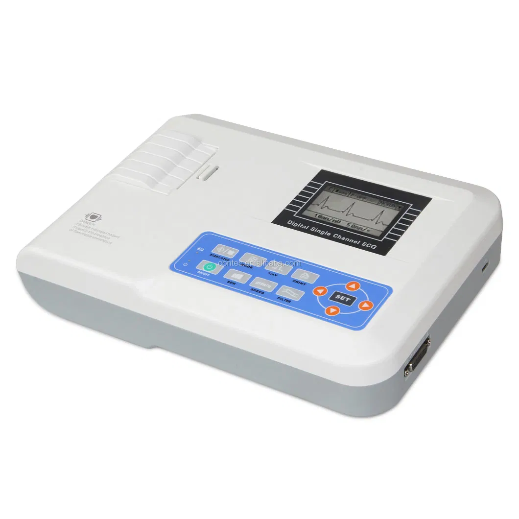 ECG Vista 4