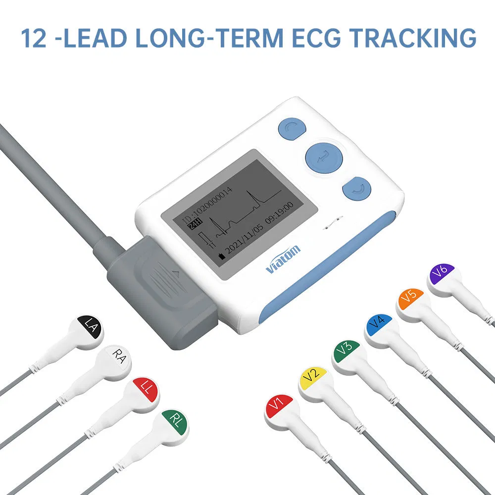 Monitor Holter ECG portátil 24-Hour 12-Lead