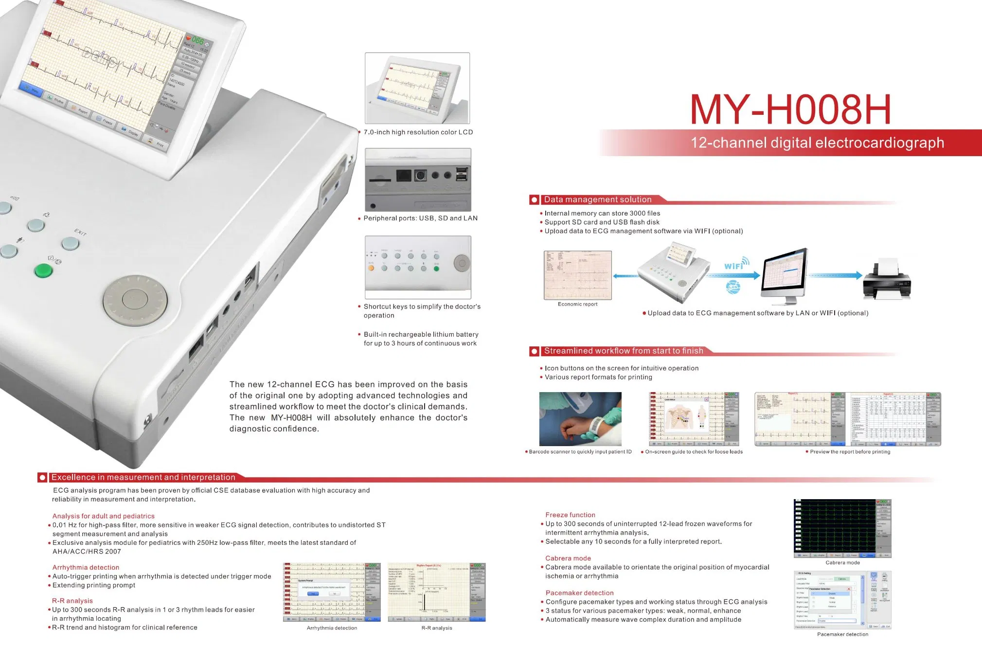 Mejor Electrocardiógrafo Digital de Doce Canales en Reposo Machine/12-Channel Precio