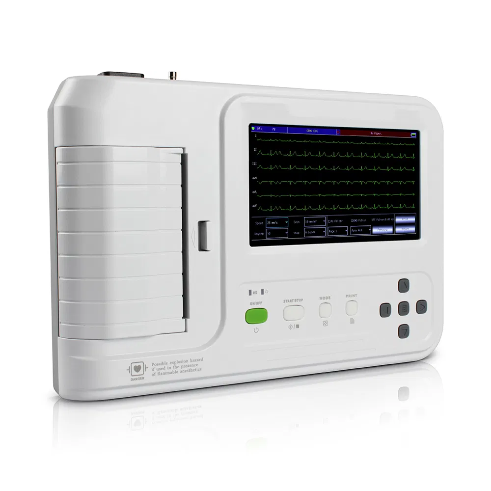 Máquina de Electrocardiografía ECG Basada en PC a Precio Económico 12 Leads 6 Canales con Análisis Diagnóstico en Tiempo Real