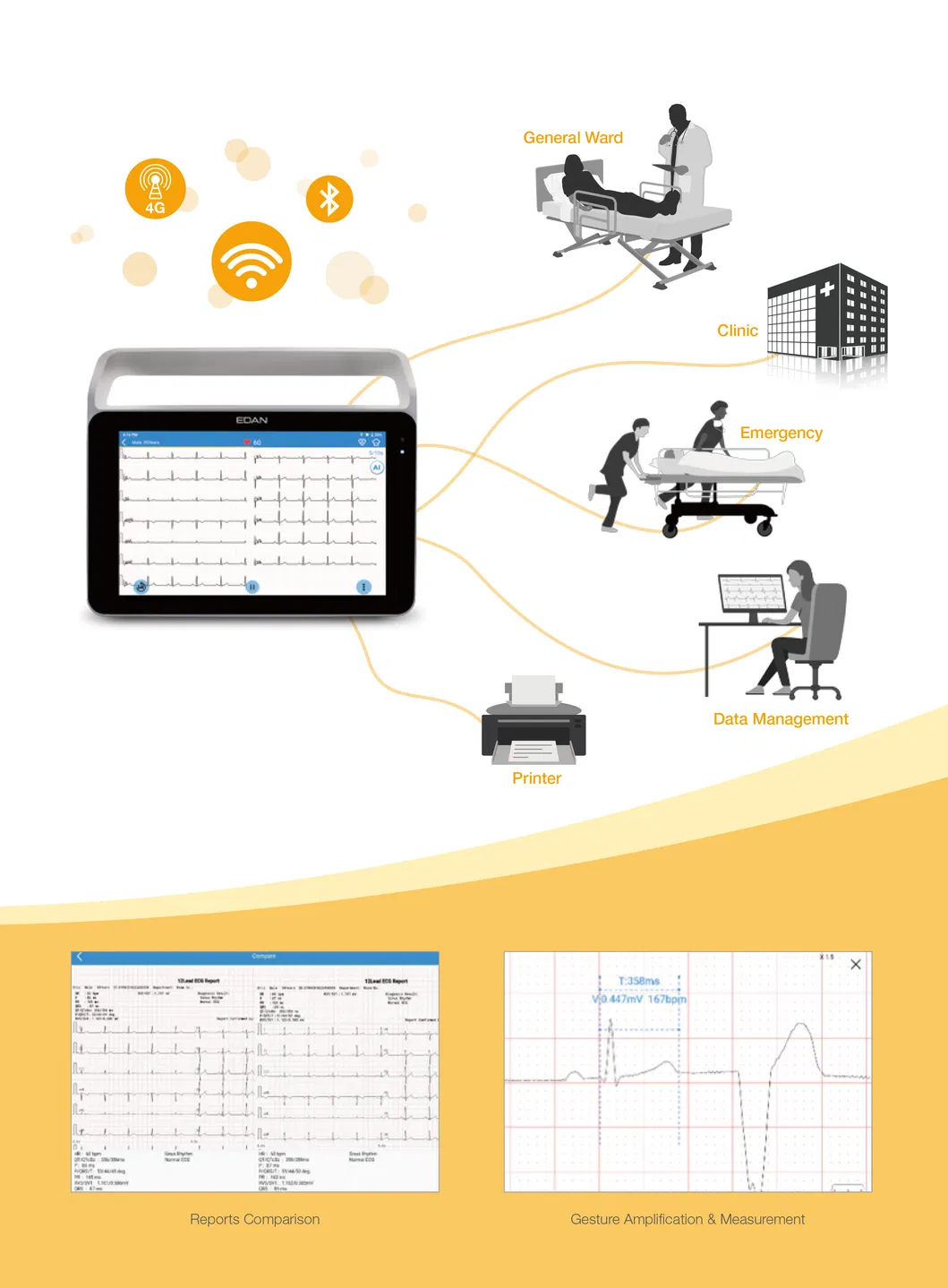 Serie ISE ECG Digital 4