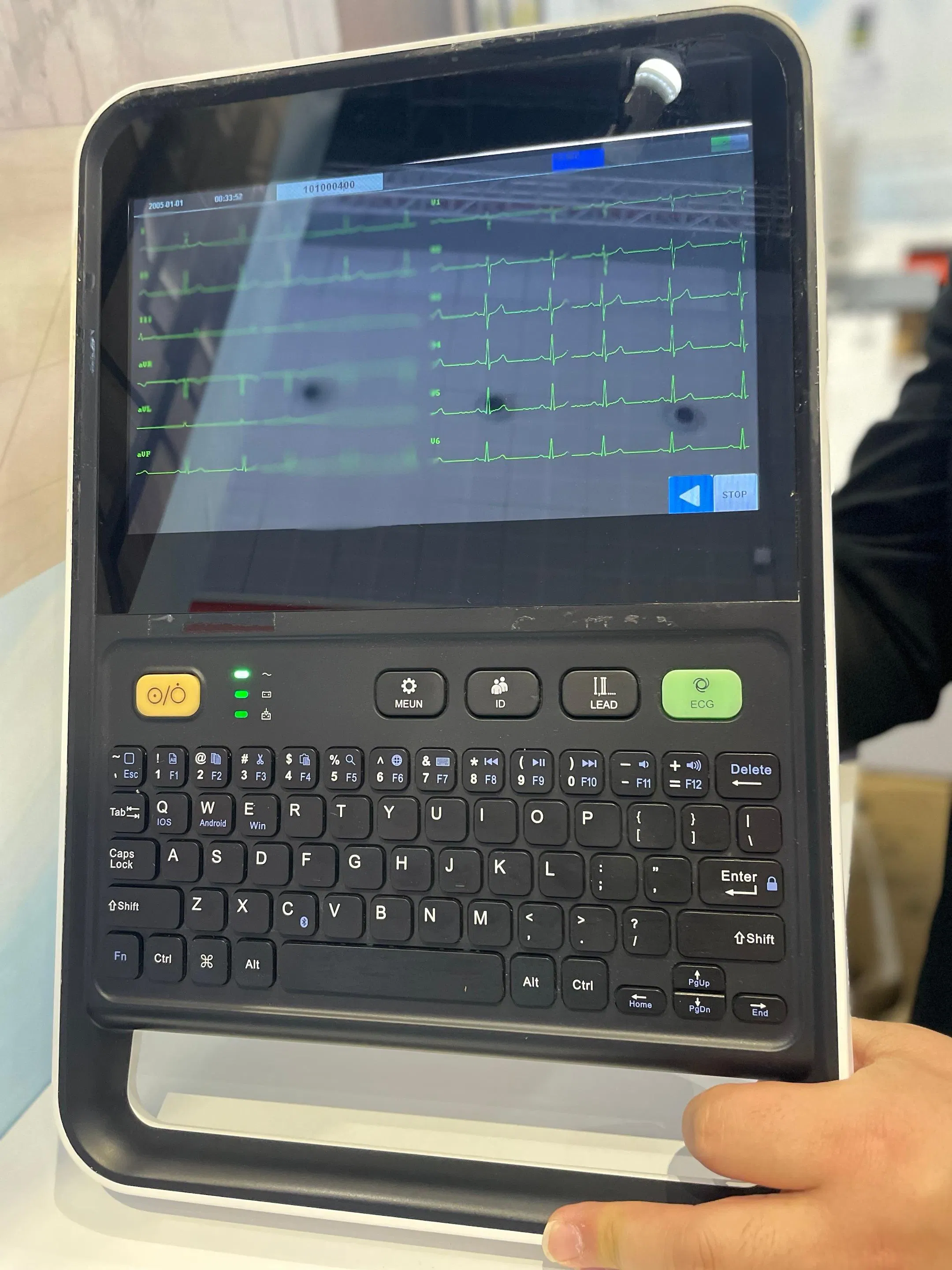 12 Máquina de ECG de pantalla táctil digital, portátil 12-Lead Electrocardiógrafo para diagnóstico cardíaco en hospitales y clínicas