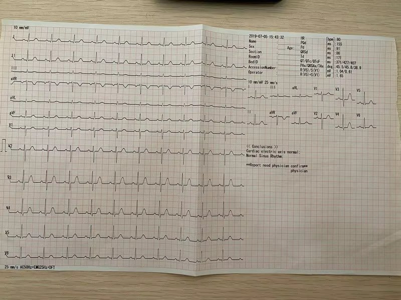 Máquina de ECG Digital 12 Portátil para Uso en Hospitales y Clínicas