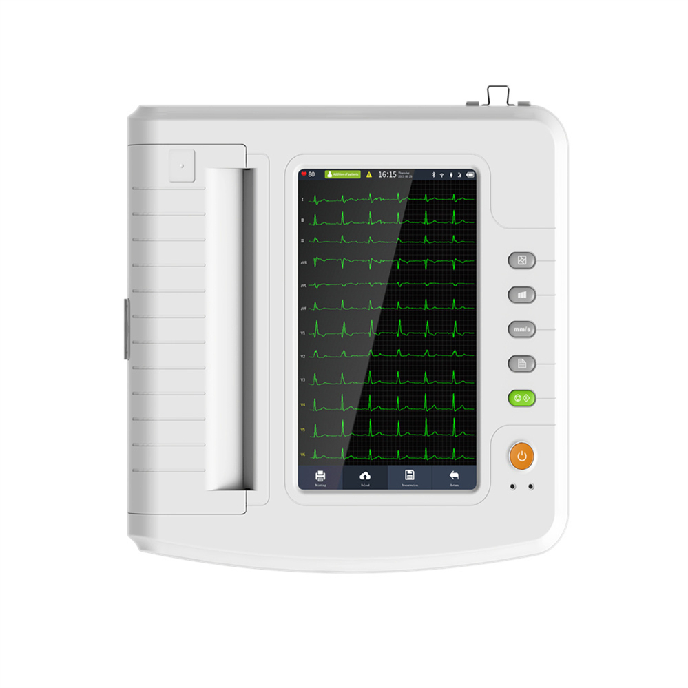 Monitor de ECG Avanzado 12-Channel con Pantalla a Color para Profesionales