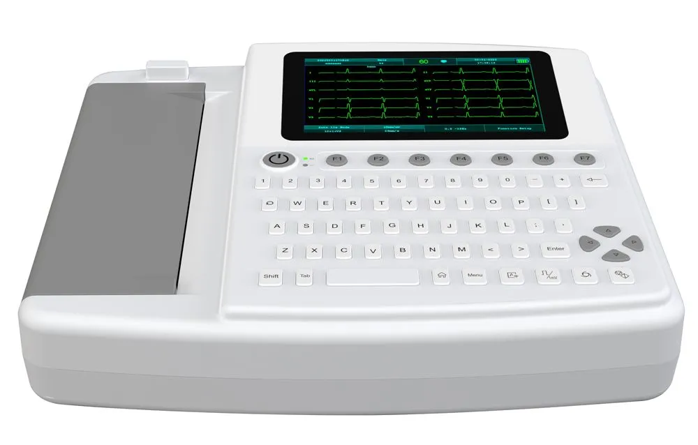 ECG Detalle 1