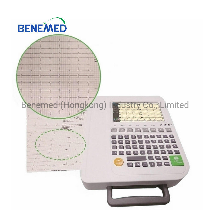 Máquina de electrocardiograma digital de alta calidad 12 canales