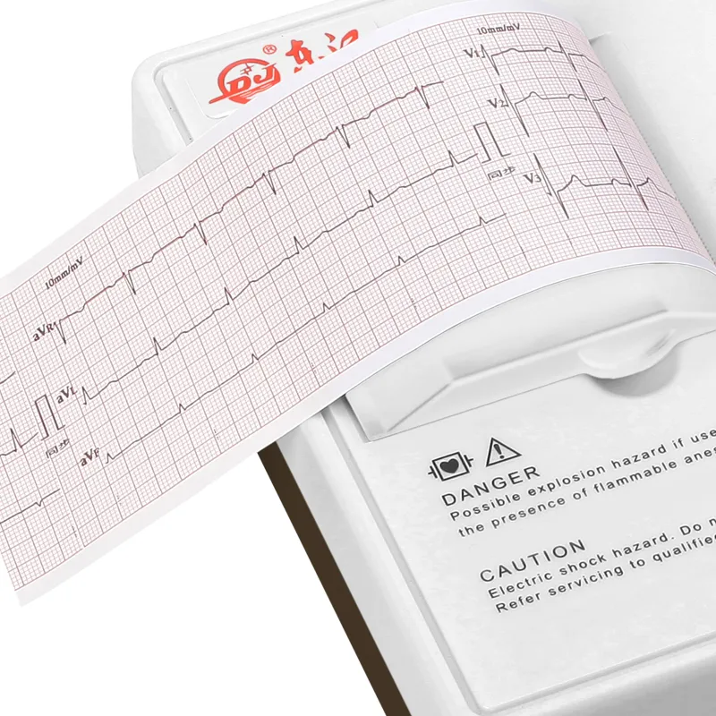 Detalle ECG 3