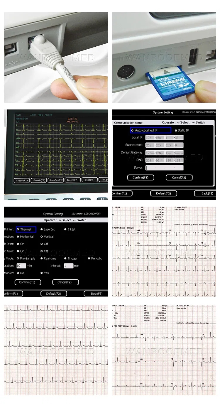 Detalles ECG1201