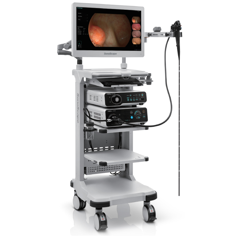 Sistema de Endoscopia Médica Sonoscape HD-550 con Sensor CMOS de Iluminación LED para Diagnóstico Gástrico 4 Full HD 1080P