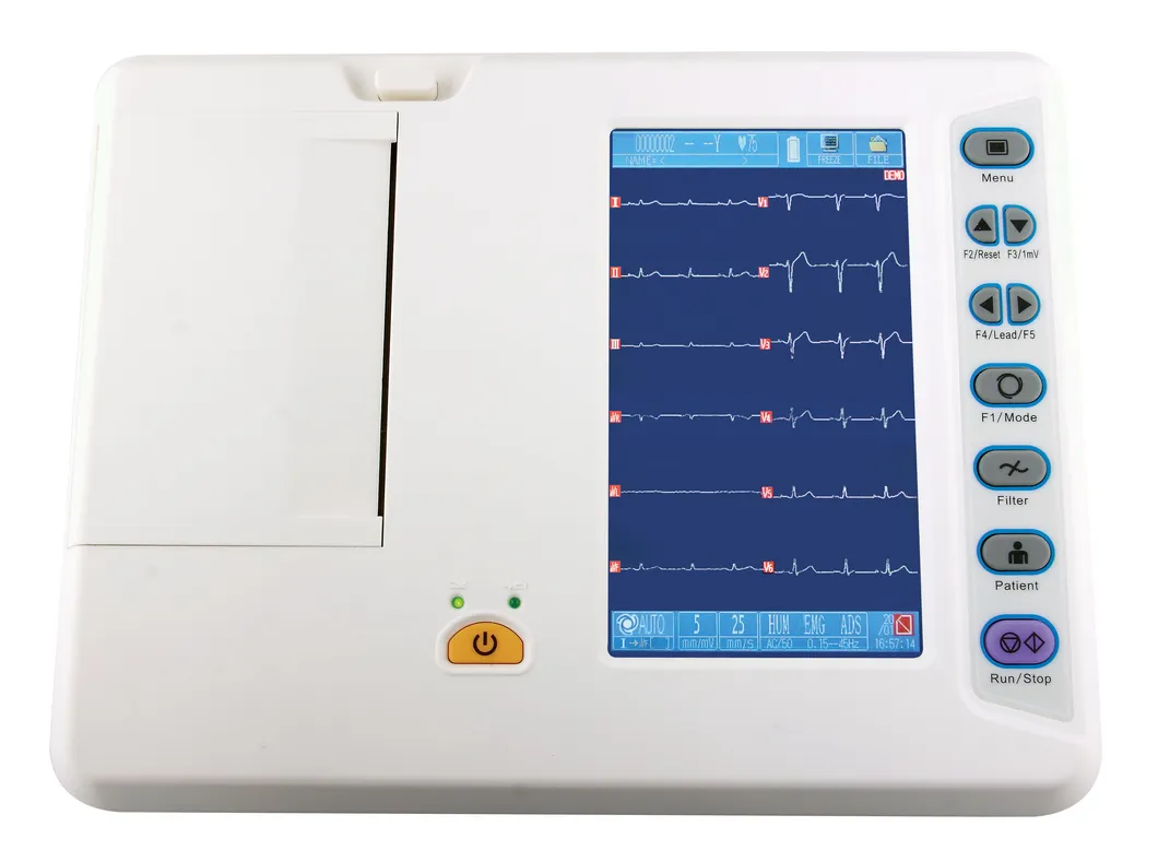 Detalle de ECG en uso