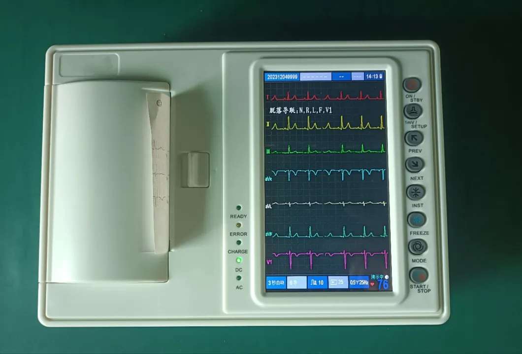 Diagnóstico ECG 3