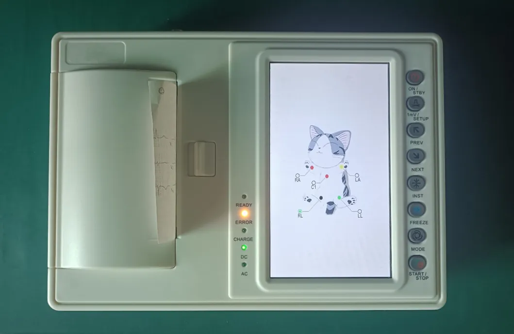 Diagnóstico ECG 1
