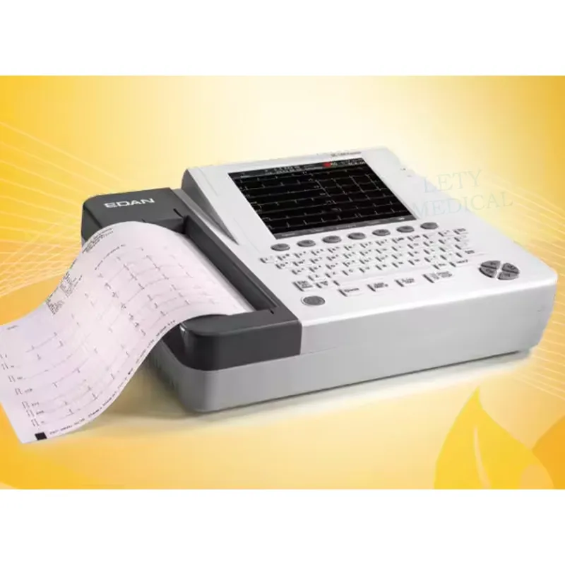 Electrocardiograma Vista 2