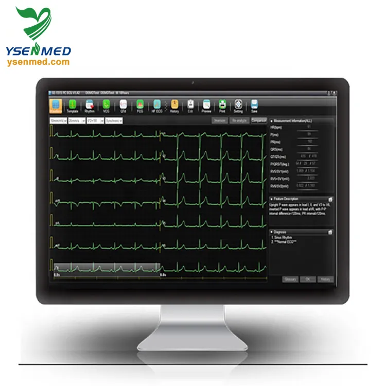 Sistema ECG Explorer SE-1515