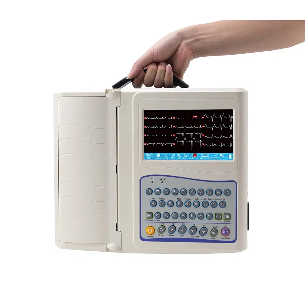Monitor ECG de Alta Precisión 12 Ideal para Diagnósticos de Cardiología y Exámenes de Rutina