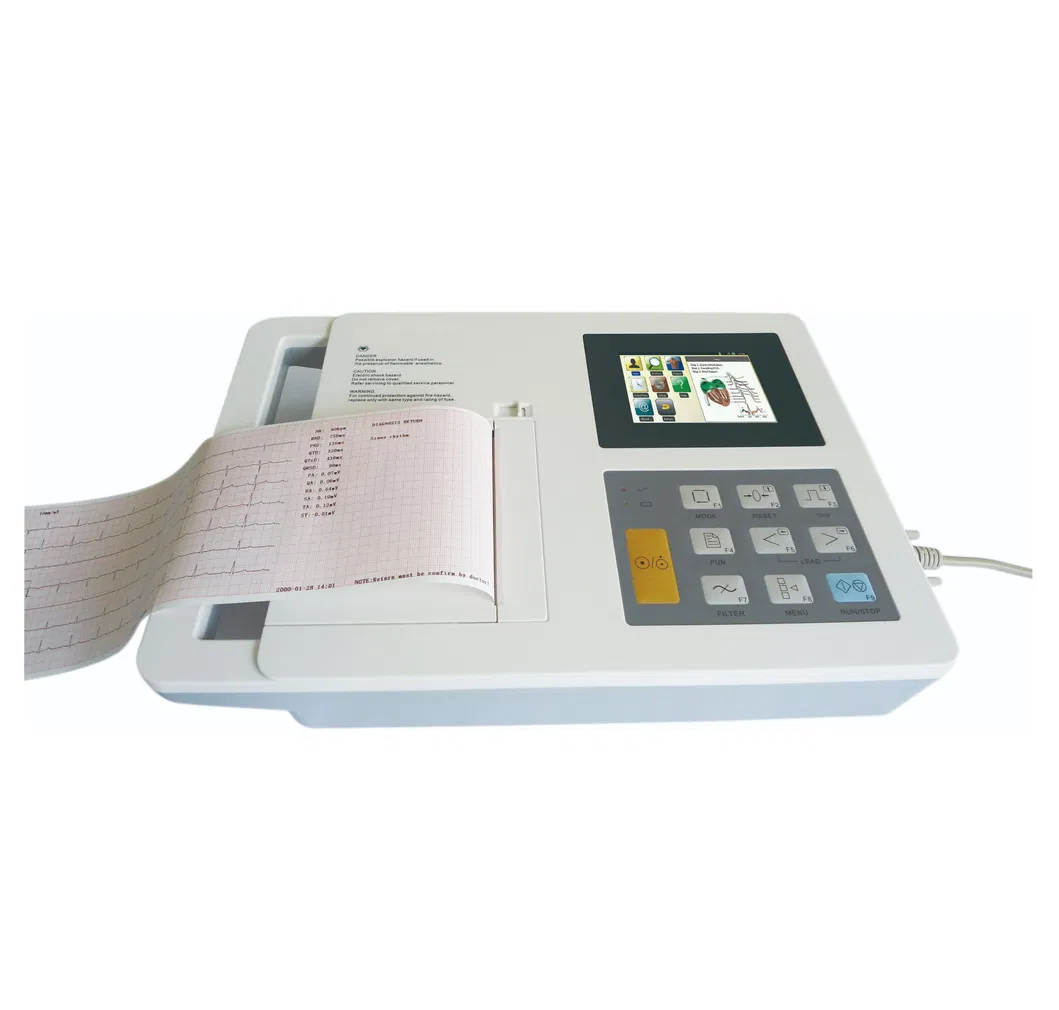 Interfaz de usuario ECG