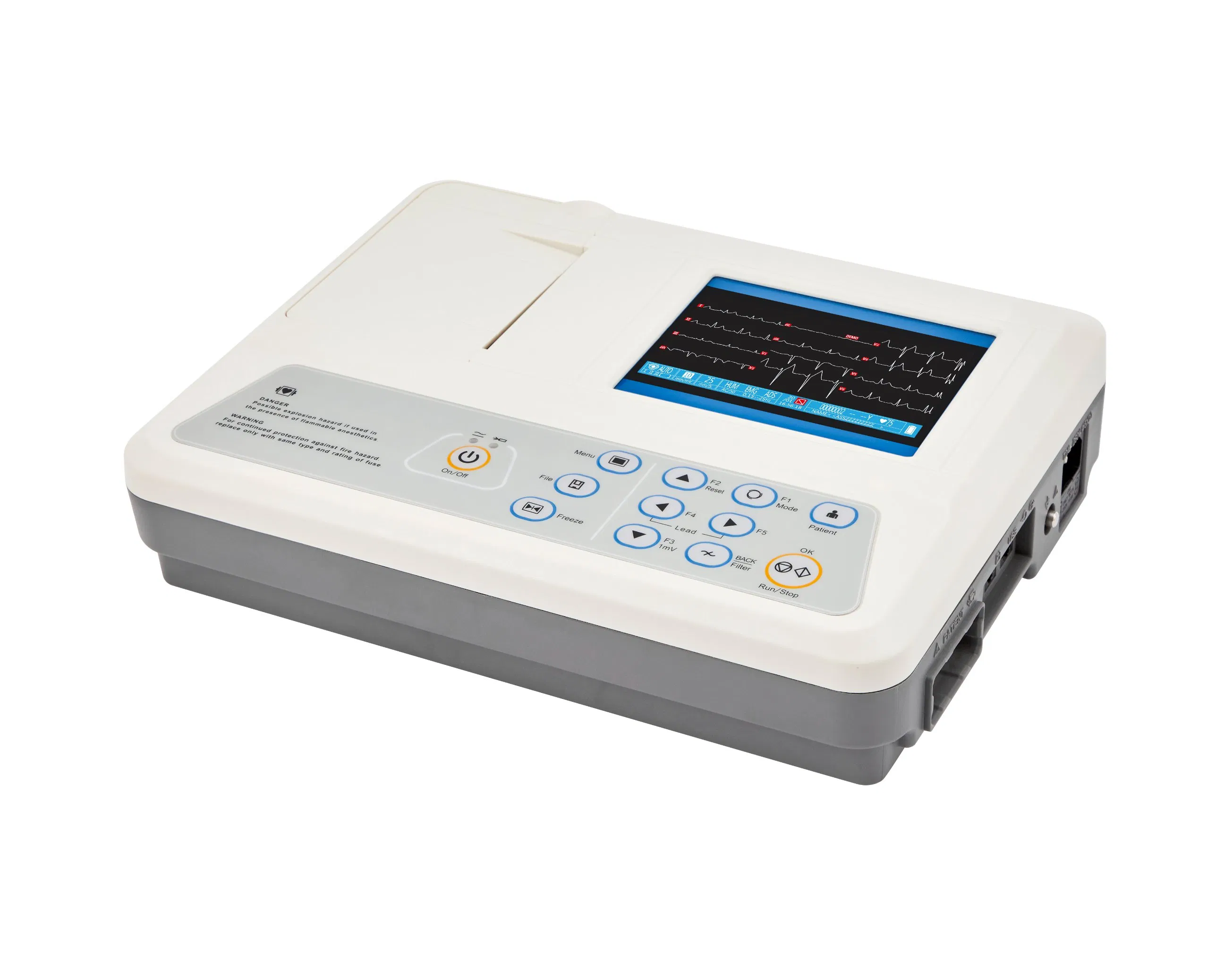 Monitor ECG de Tres Canales con Pantalla Digital para Diagnóstico Cardíaco Preciso