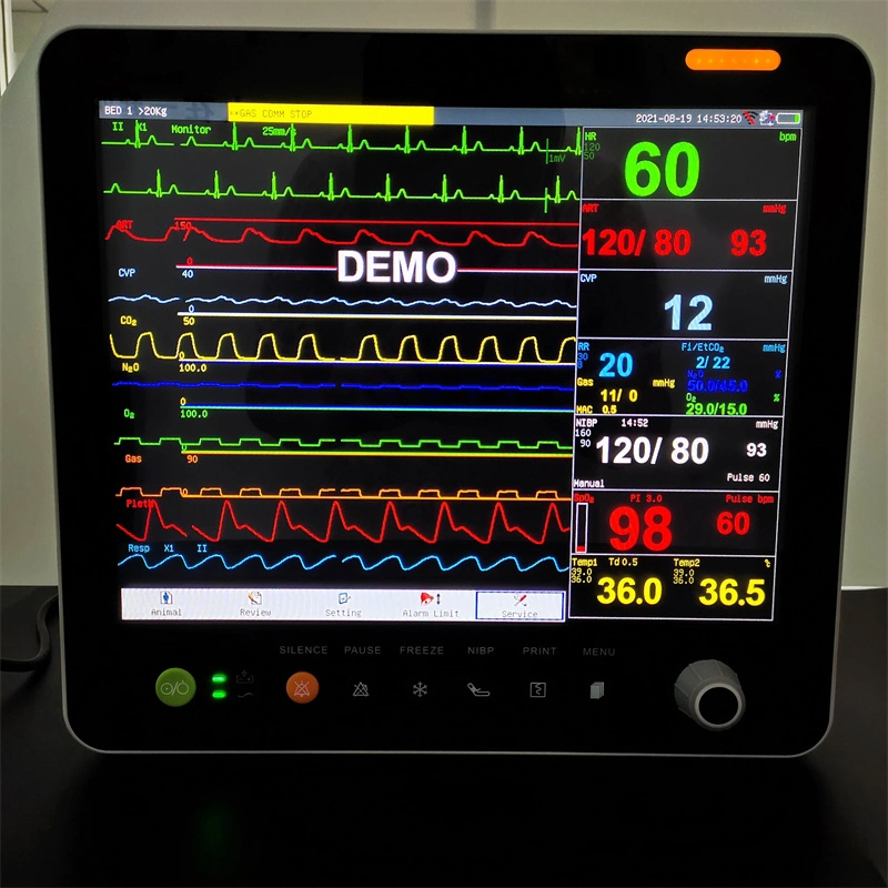 Equipo Médico Veterinario Monitor de Paciente Multíparametro 15 Pulgadas