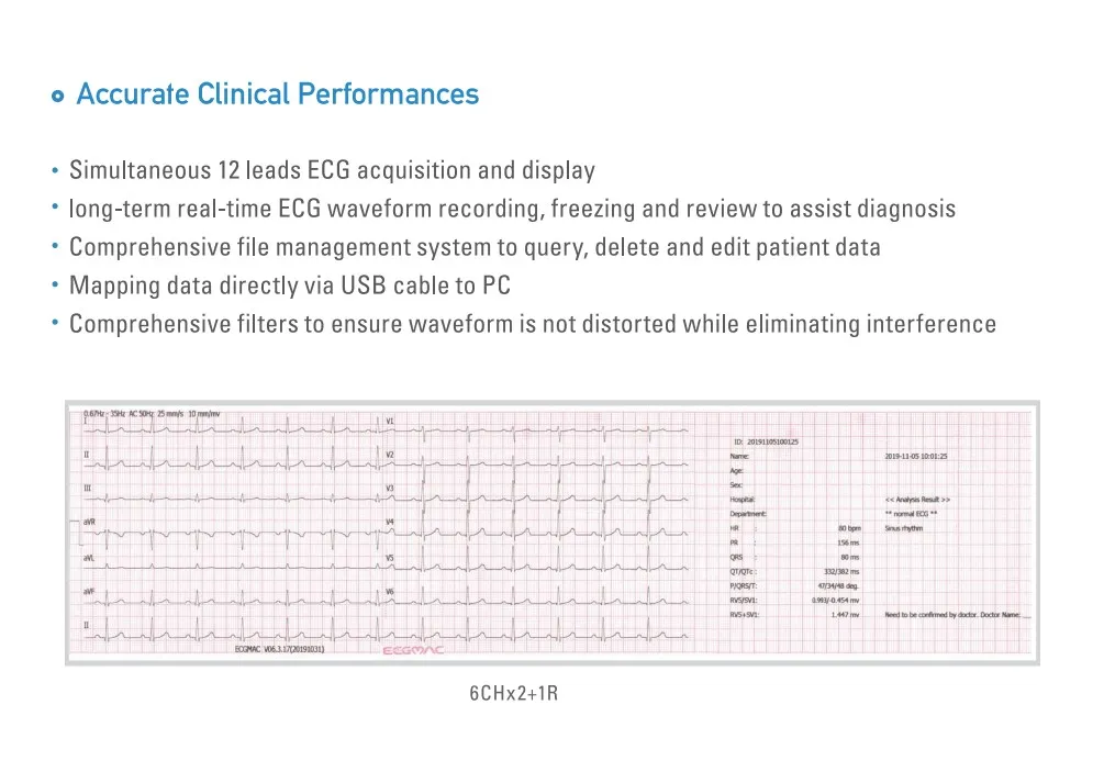 Máquina de Electrocardiografía ECG 3