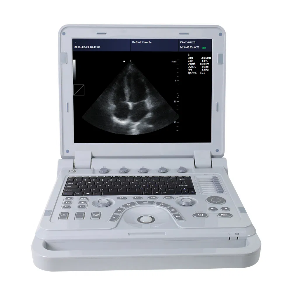 Máquina de Ultrasonido Veterinario Premium con Tecnología Doppler Color