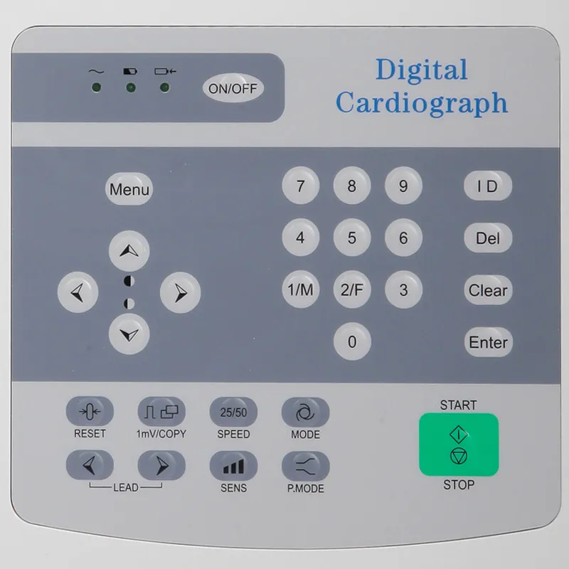 ECG Detalle 5