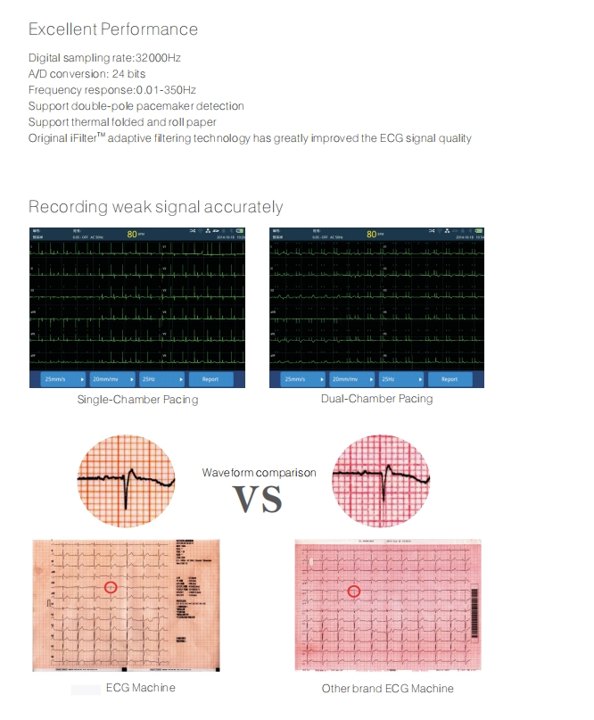5-Inch Máquina de ECG con pantalla inclinada U30 ECG portátil