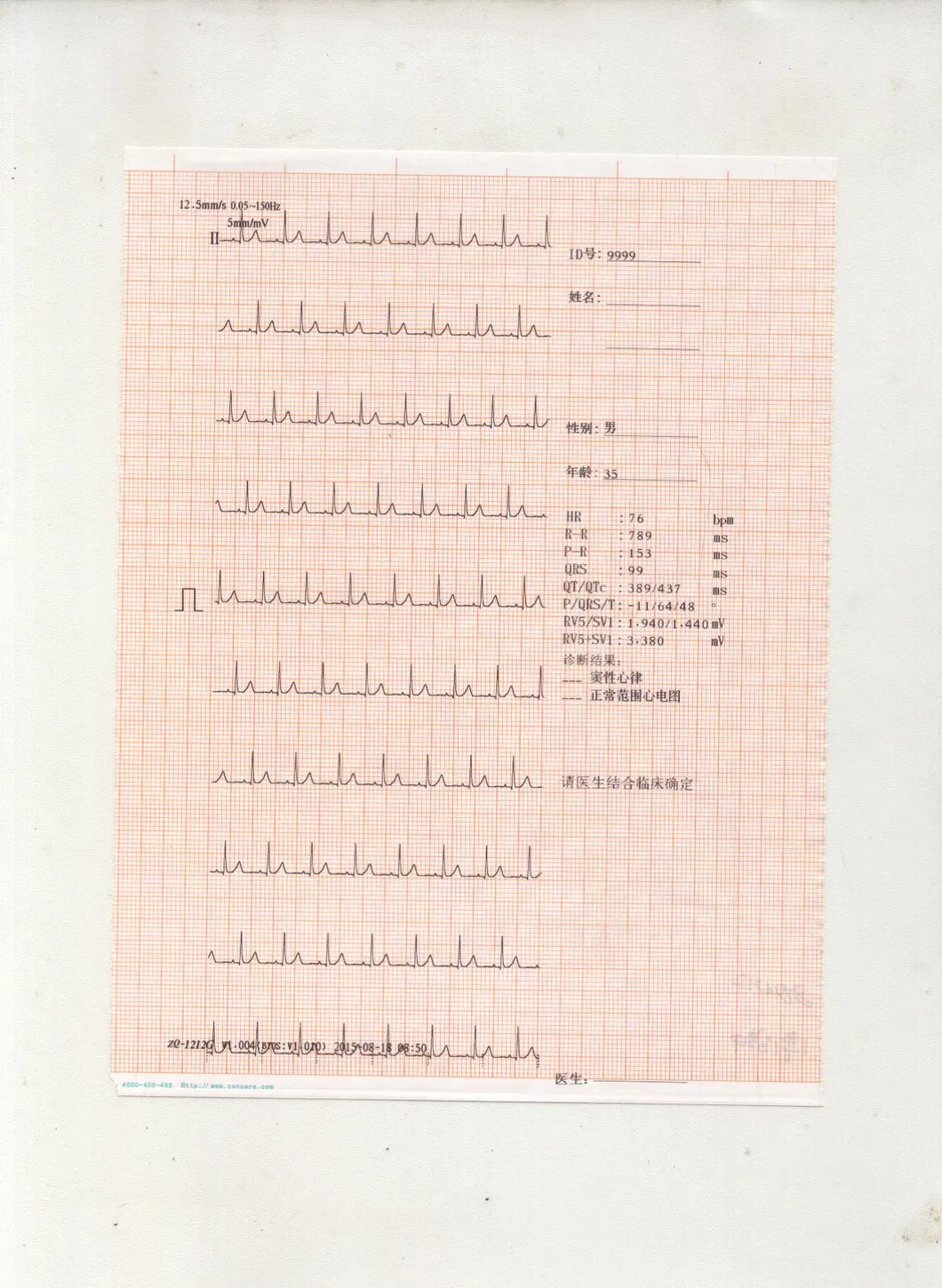 Detalle ECG Completo