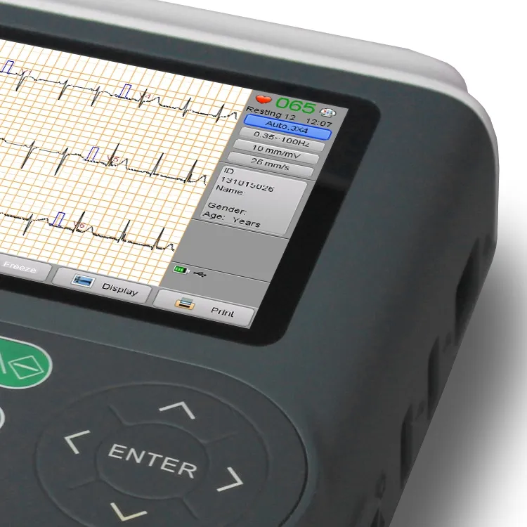 Detalle ECG 4